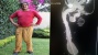 WOW,  Panjang Penis Pria Asal Amerika ini hingga Selutut Orang Dewasa