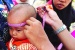 Prihatin, Masih Ada 956 Kasus Anak Kurang Gizi di Karimun